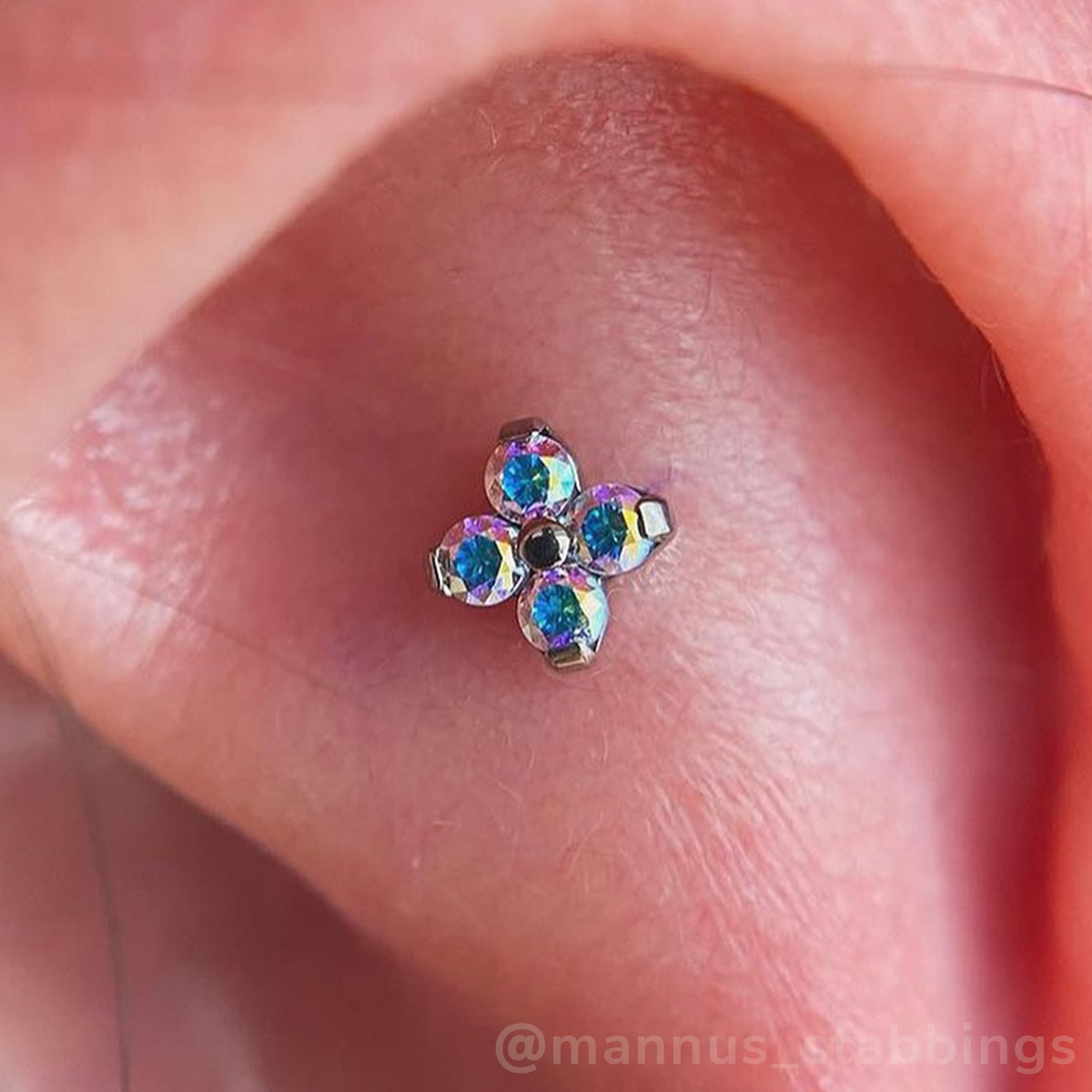 Titanium Forte Gem End - NeoMetal Inc