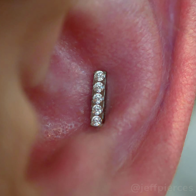 Titanium Gem Bar Ends - NeoMetal Inc