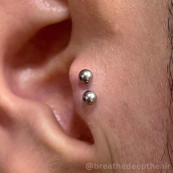 Titanium Ball End - NeoMetal Inc